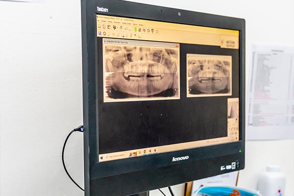 Antenatal Sonar & Midwife services